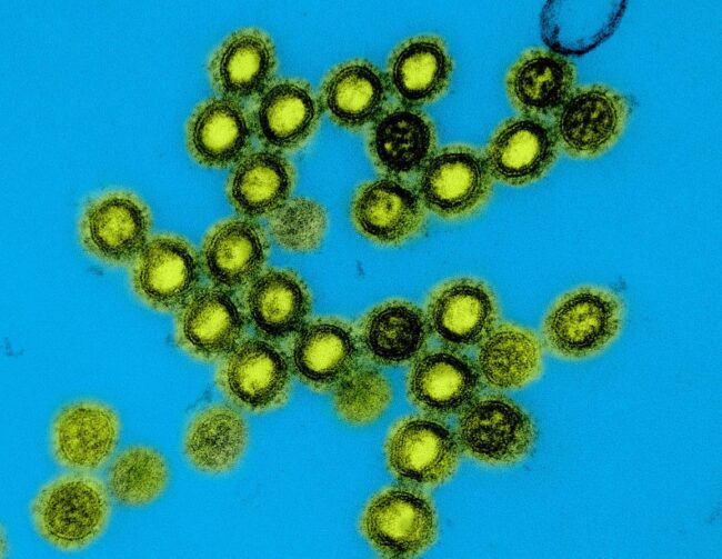 20250401-h1n1